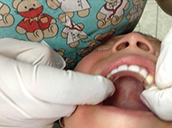 Dentista para niños